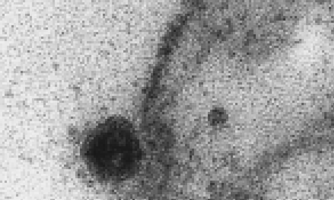USP: novo coronavírus infecta e se replica em glândulas salivares