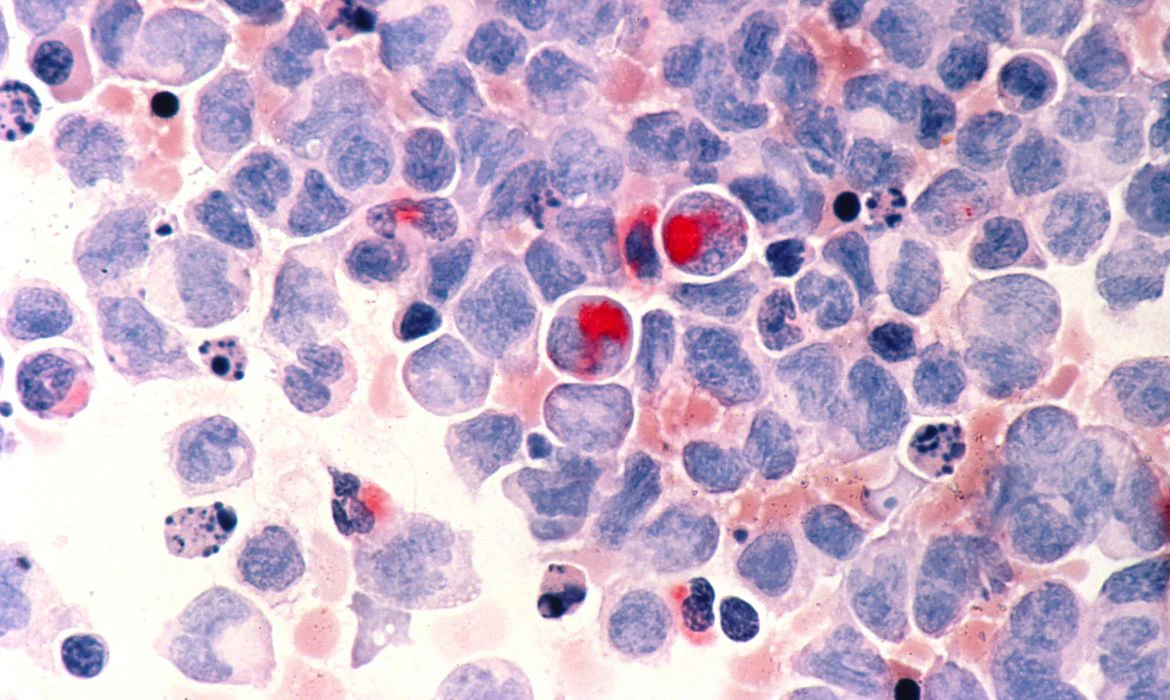 São Paulo lança programa de terapia celular para tratamento de câncer