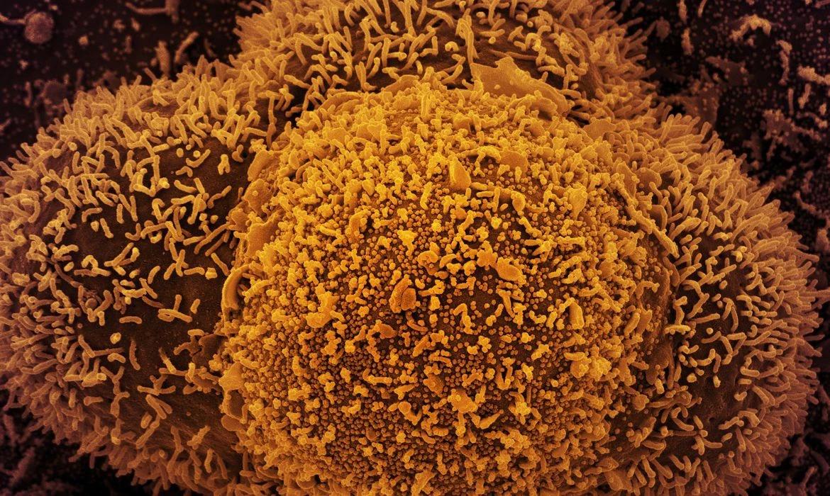 Fiocruz alerta para alta de casos de covid-19 em quatro estados