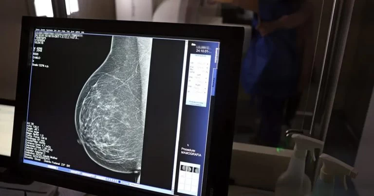 Tecnologia do micro-ondas propõe alternativa mais confortável e acessível à mamografia tradicional, mostra estudo