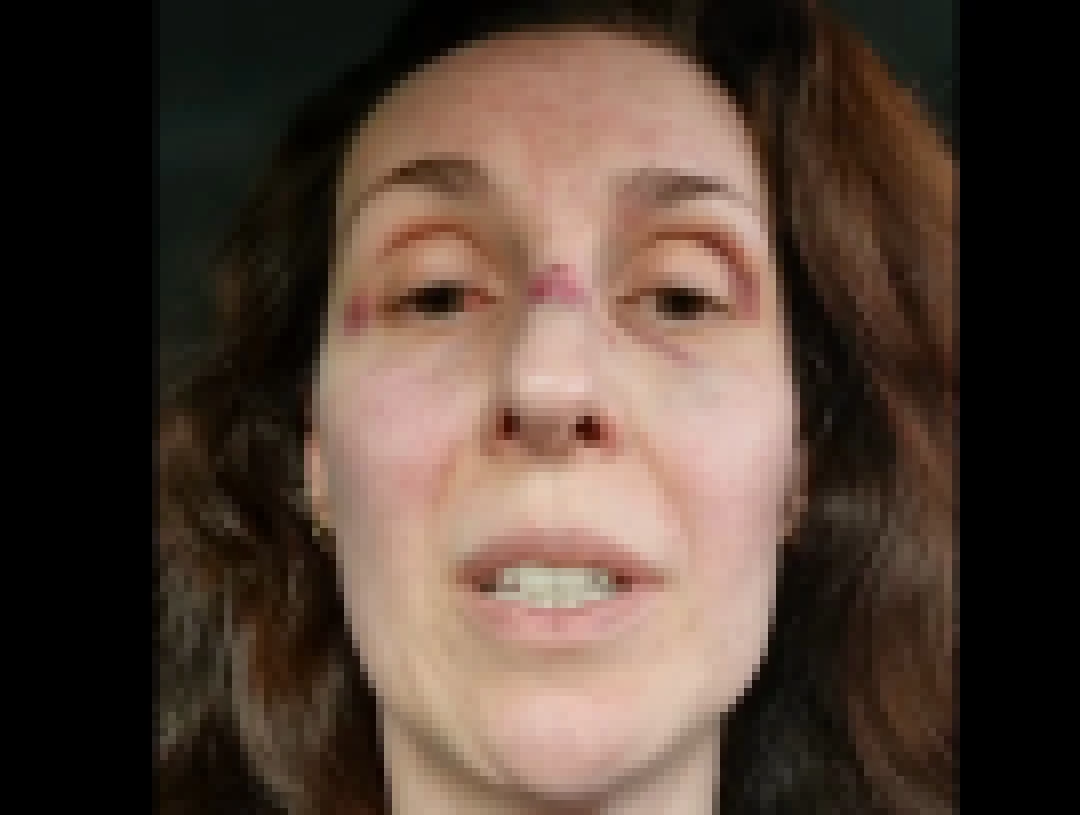 Médica psiquiatra agredida no CAPS de Iperó usa redes sociais para denunciar “desmonte”, “falta de investimento” na unidade e até mesmo atuação de funcionários inexperientes