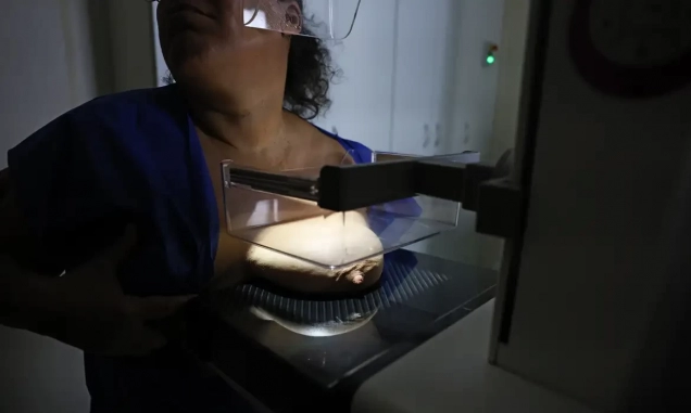 ANS defende que plano cubra mamografia digital sem restrição de idade