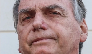 Bolsonaro apresenta piora clínica e vai passar por novos exames