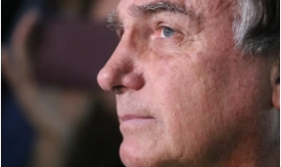 Após pedido de cirurgia, Moraes manda PF fazer perícia em Bolsonaro