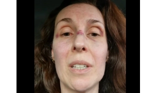 Médica psiquiatra agredida no CAPS de Iperó usa redes sociais para denunciar “desmonte”, “falta de investimento” na unidade e até mesmo atuação de funcionários inexperientes